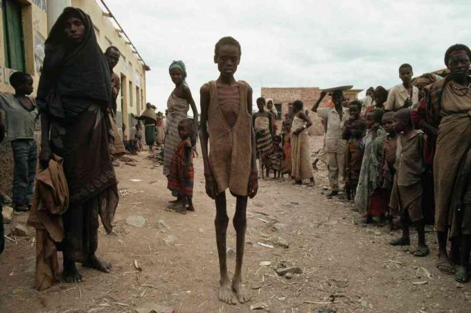 Oběti hladomoru v důsledku somálské občanské války.