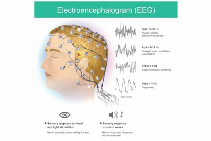 EEG