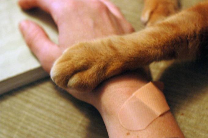 Obvazovaná lidská ruka a kočičí tlapa.